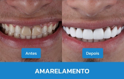 AMARELAMENTO 2