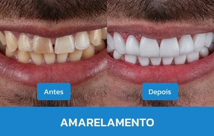 AMARELAMENTO 3
