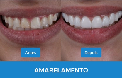 AMARELAMENTO 4